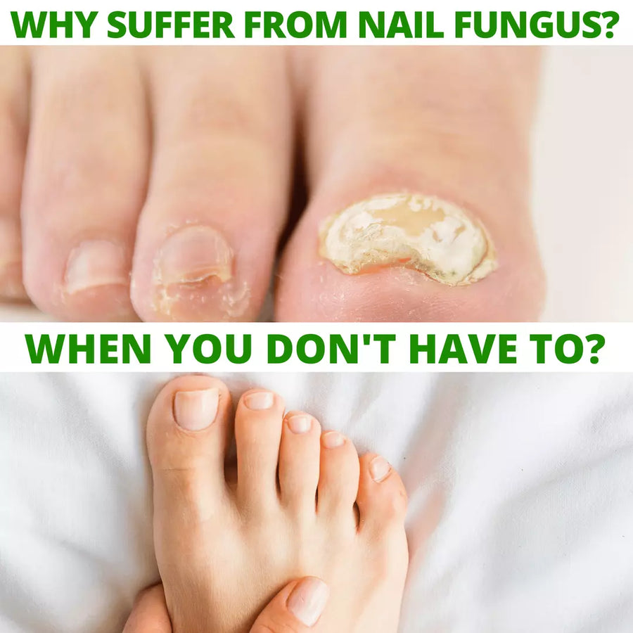 12 - Dr. Cole's Nail Fungus Balm